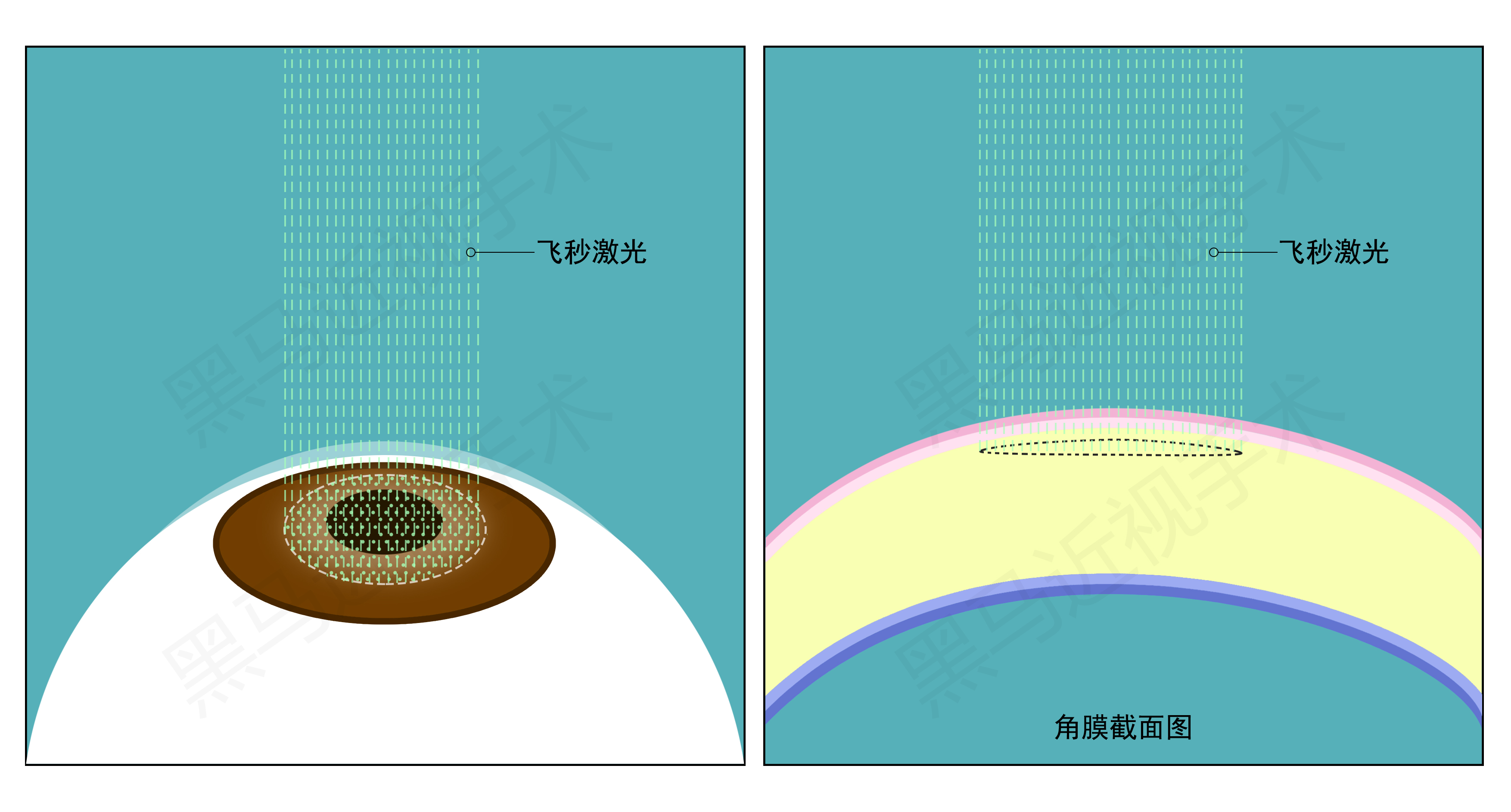 黑马眼科